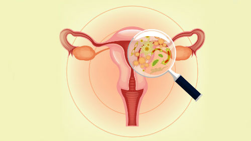 tratar vaginosis con ovulos