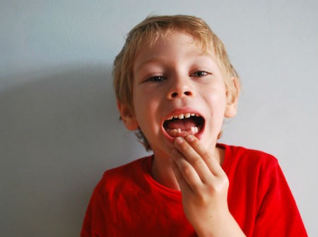 Bancos de dientes de leche