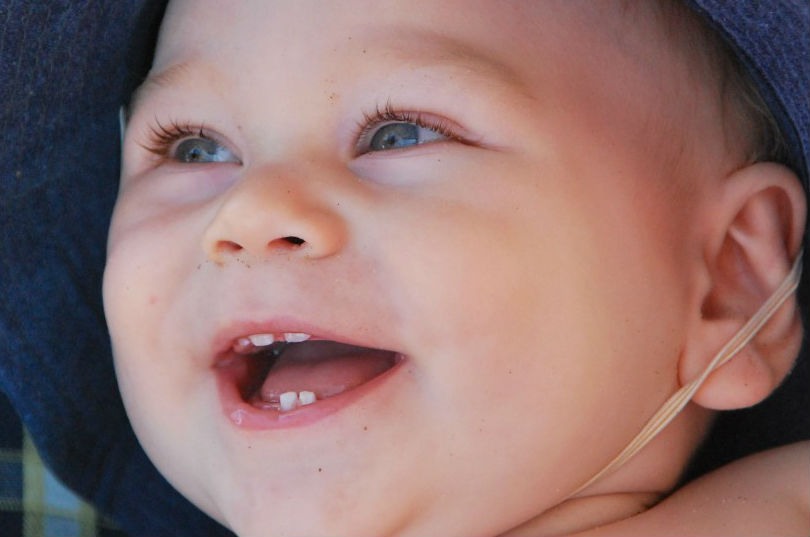 dientes de leche fuente de celulas madre