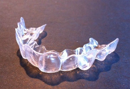 Alineadores invisalign