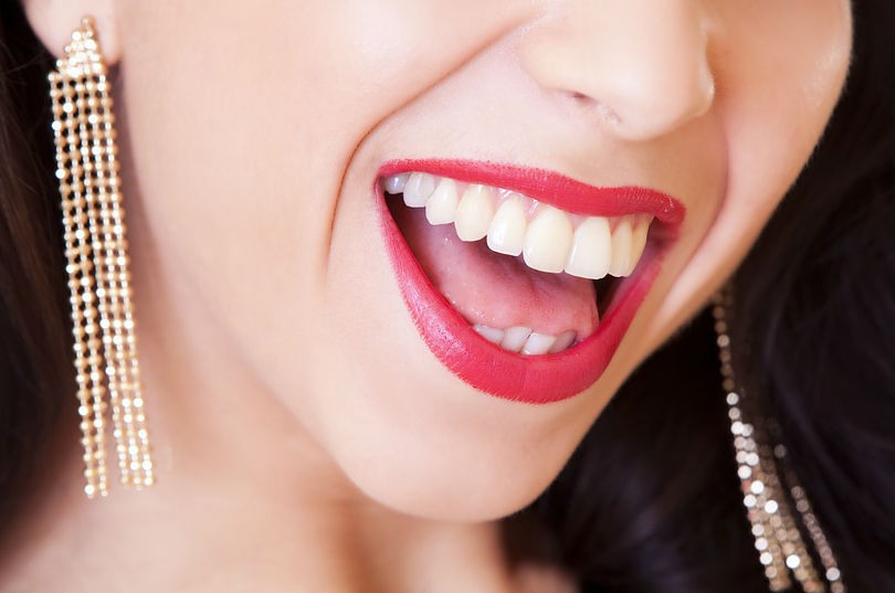 Estetica dental