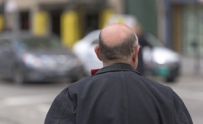Trasplante capilar en Turquía