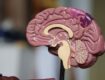 Cerebro