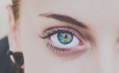 Ojo