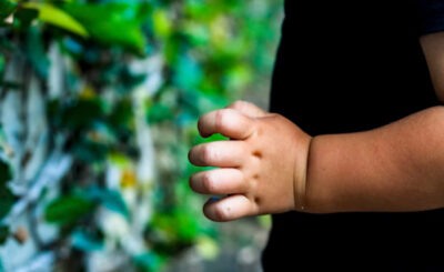 Obesidad infantil